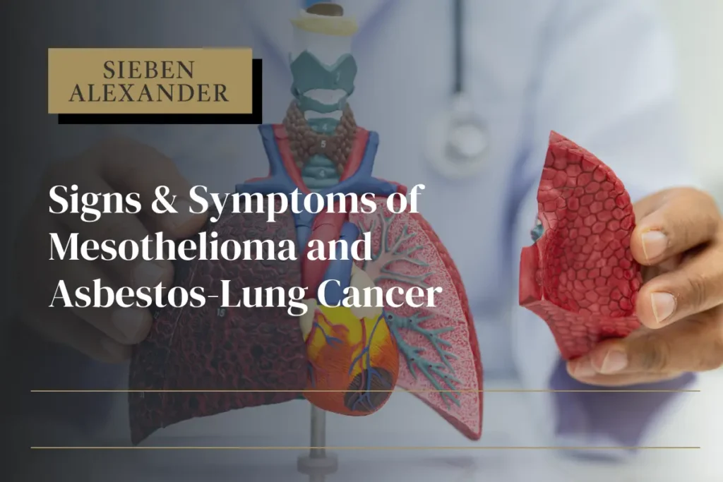 An image of a doctor holding a plastic lung with the text "Sieben Alexander Signs Symptoms of Mesothelioma and Asbestos Lung Cancer"