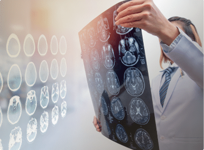 A doctor holds up images of a brain