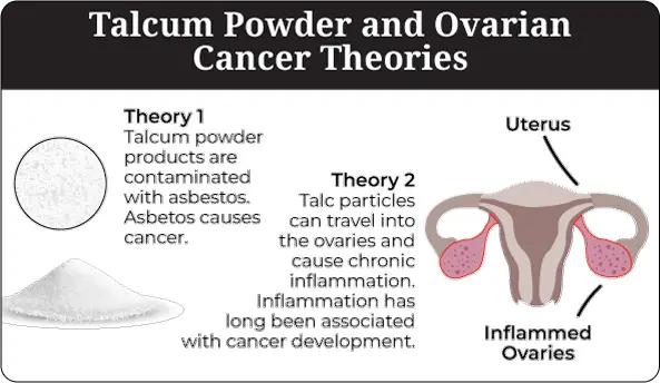A chart displaying 2 theories as to how talcum powder relates to ovarian cancer
